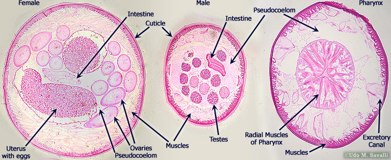 <p>Ascaris x.s. </p>