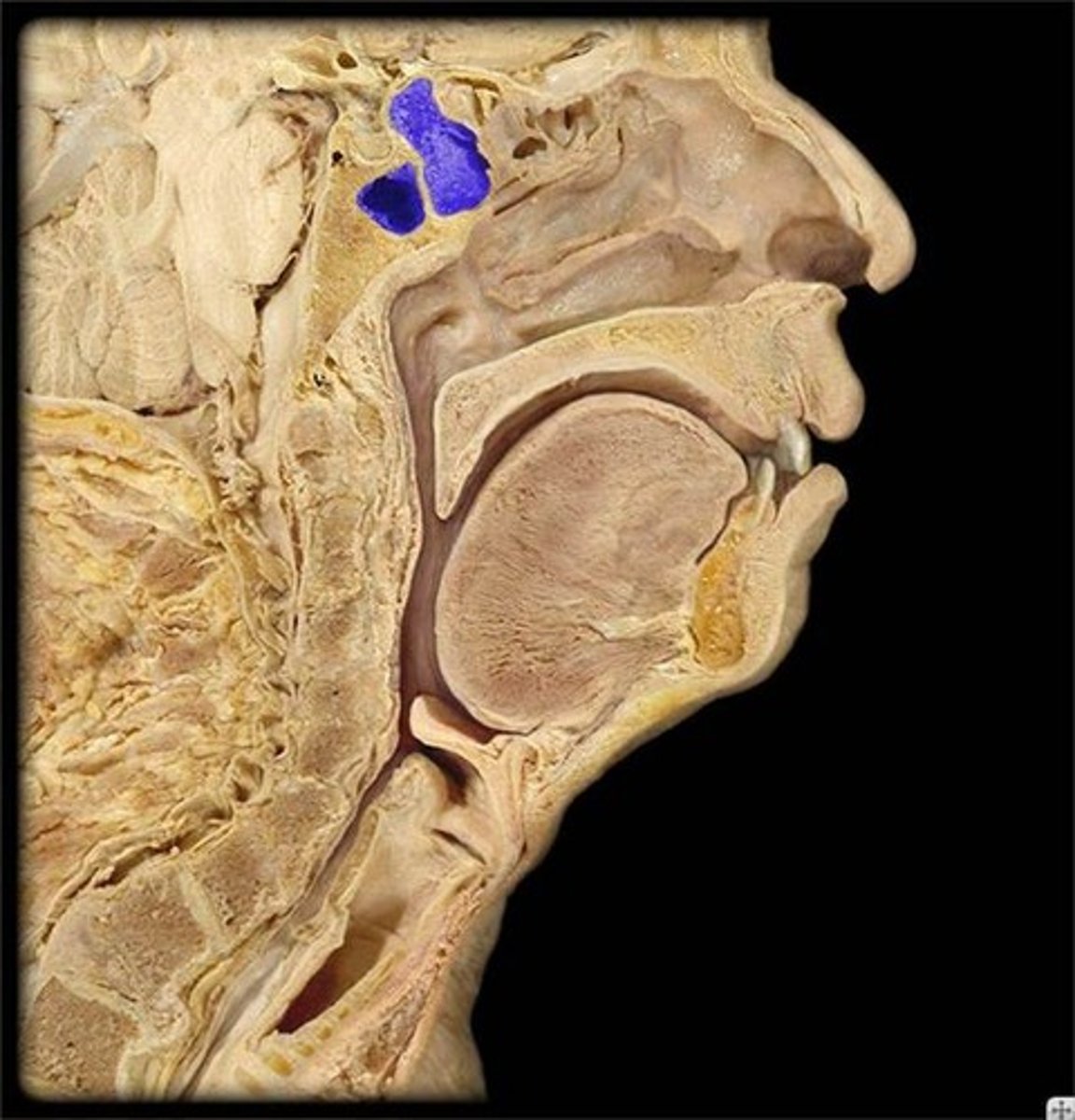 <p>Identify this space.</p>