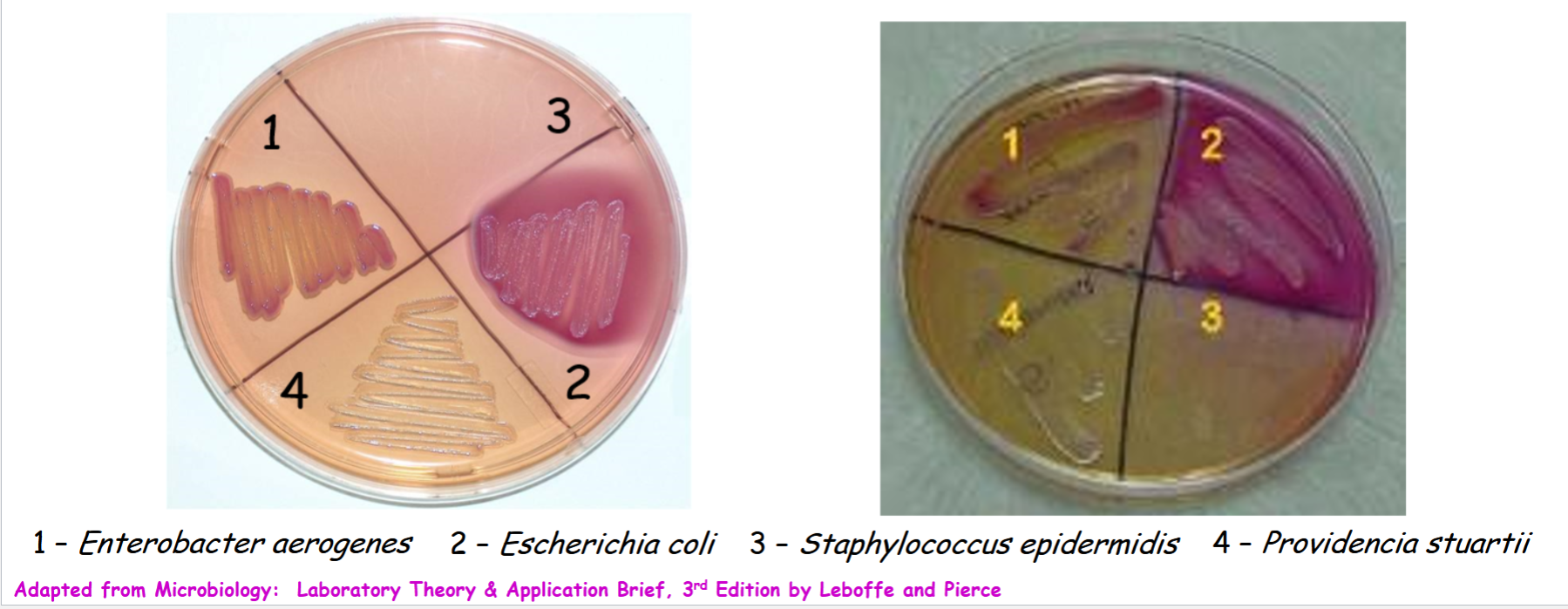 <p>Know how Escherichia coli should have grown on the MacConkey agar</p>