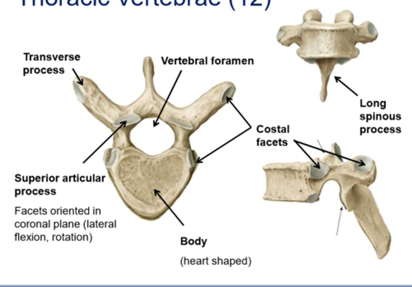 <p>body, spinous process, transverse process, vertebral foramen</p>