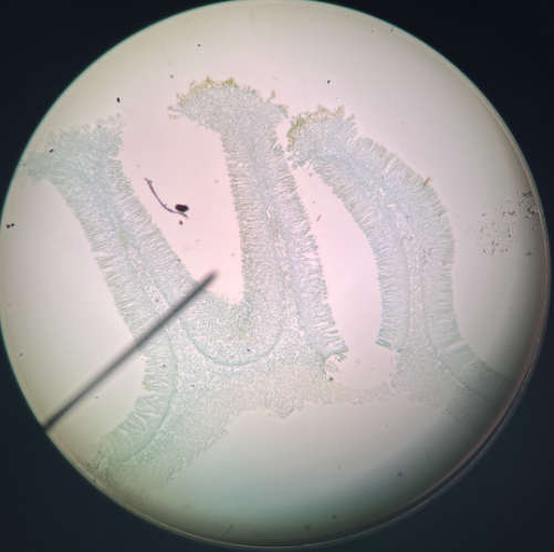 <p>What is this called</p>