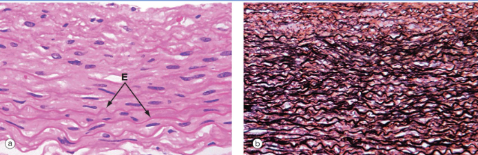 <ul><li><p>It contains alternating layers of <strong>smooth muscle cells </strong>and elastic <em>laminae</em></p></li><li><p><em>Left </em>(H&amp;E) shows SMCs and elastic fibers (<strong>E)</strong>; right, elastin staining (<strong>black</strong>)</p></li><li><p>Right out of the ventricles</p></li><li><p>Function is to receive energy from when the heart contracts, stores it and releases the energy to pump the blood around the body. </p></li></ul><p></p>