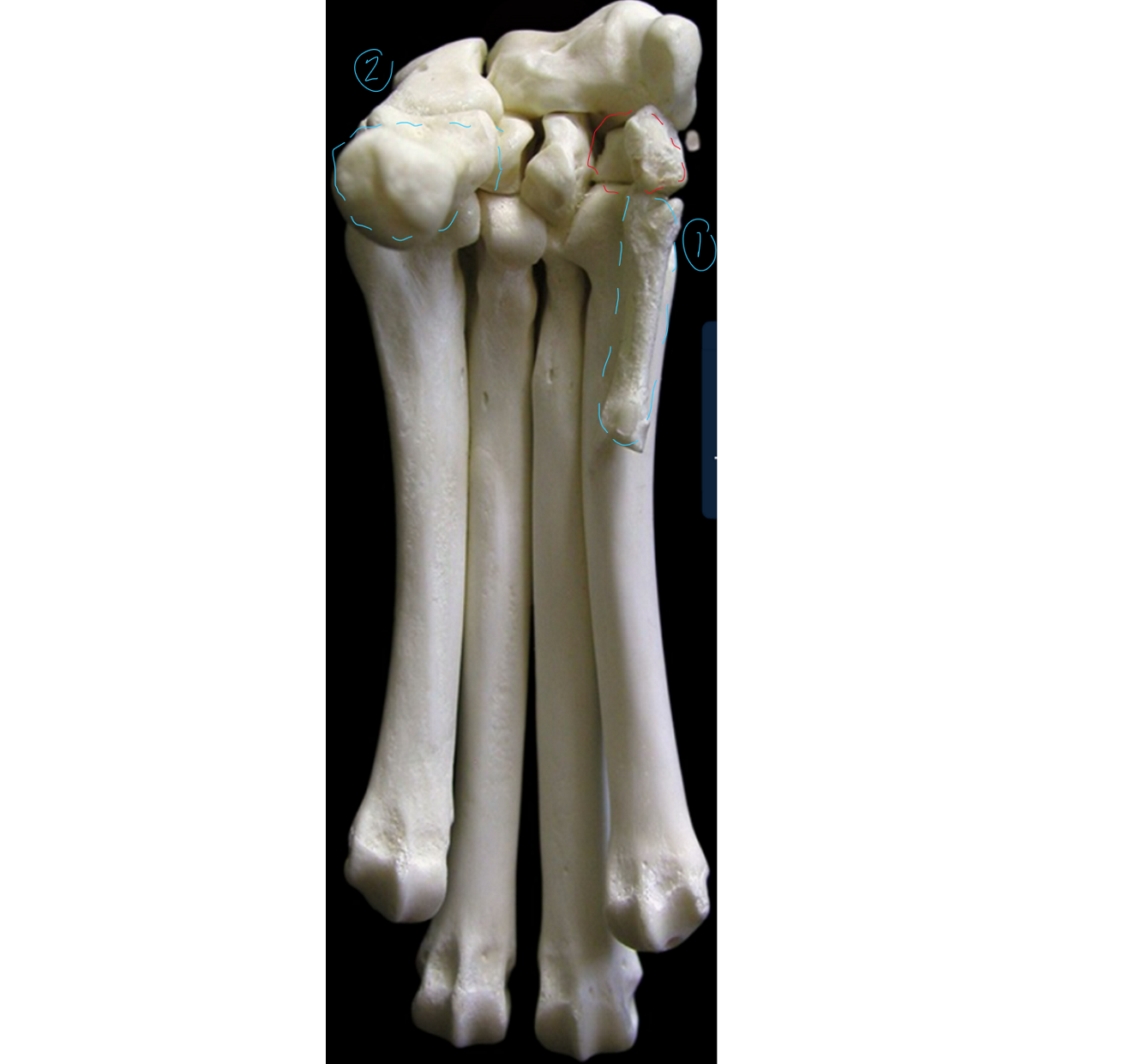 <p>label the palmar/bottom view of the carpus/metacarpus (this is like looking right under the dogs foot, medial to right, lateral to left → first carpal bone in red)</p><p></p><p>1 → SPELLING</p>