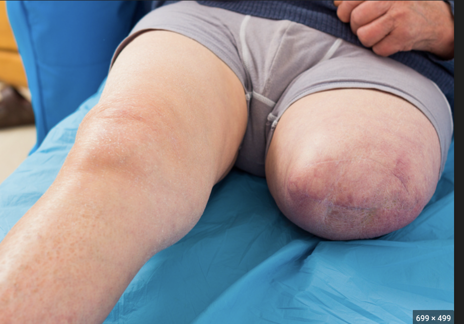 <p>Clinical view: phantom pain</p>