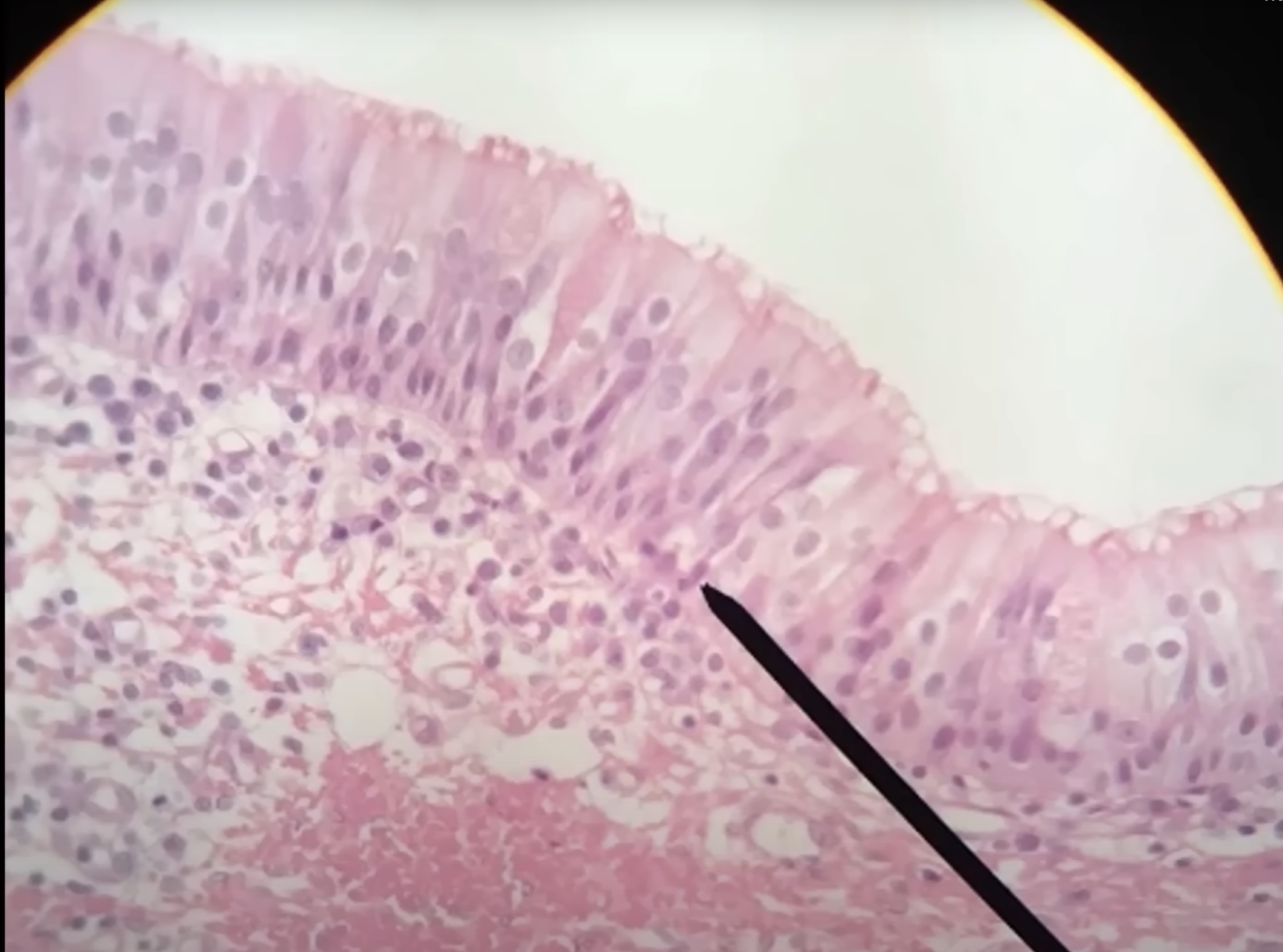 <p><strong><u>Ciliated</u> Pseudostratified Columnar Epithelium</strong></p><p>Location: <span style="color: red;"><strong><u>Nasal cavity</u></strong></span></p><p>Function: <strong><u>Protection</u></strong></p><p></p><p>→ Pseudo = fake Stratified = layers</p><p></p><p><strong>Pseudostratified <u>Ciliated</u> Columnar Epithelium</strong></p><ul><li><p>Nuclei = <u>up &amp; dow</u>n, squished</p></li><li><p>Cilia on apical surface (moves substances across apical)</p></li><li><p>All will have <u>attachment</u> to the <u>basement membrane</u></p></li></ul><p></p>