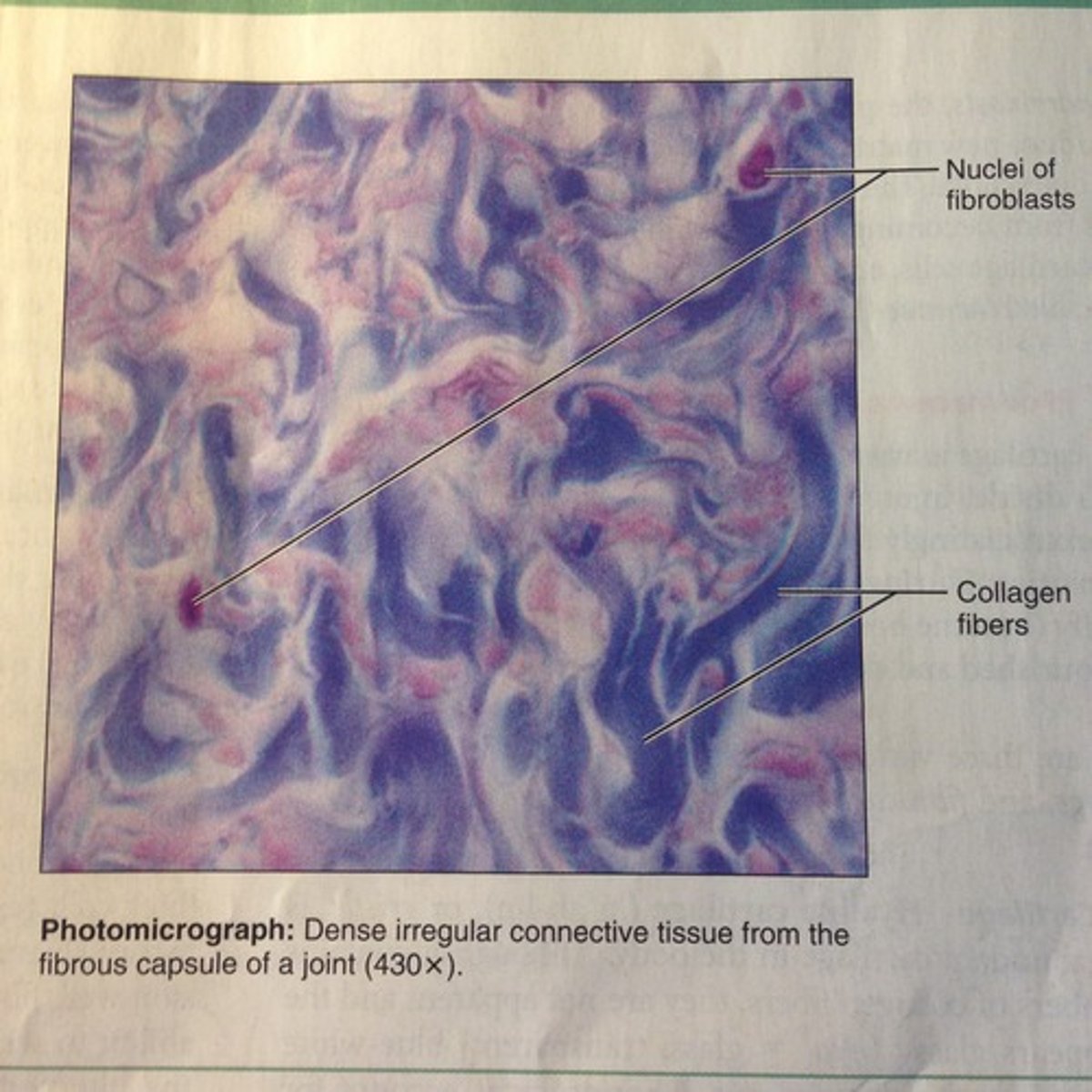 <p>- primarily irregularly arranged collagen fibres</p><p>- main cell type is fibroblasts</p>