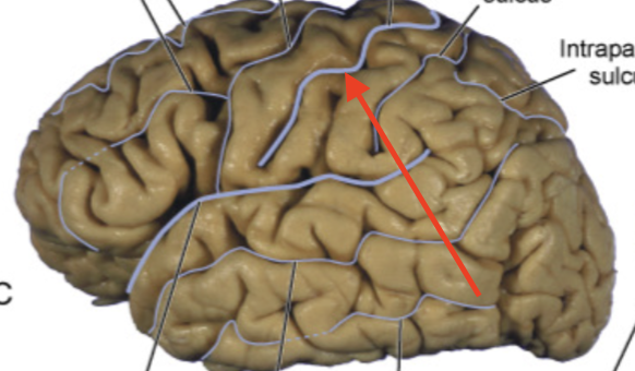 <p>separates frontal and parietal lobes “fissure of Ronaldo”</p>