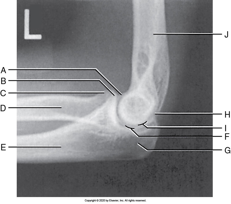 <p>Identify the labeled "H" anatomy inn the image below:</p><p>Coronoid</p><p></p><p>Humerus</p><p>&nbsp;</p><p>Capitulum</p><p>&nbsp;</p><p>Radial head</p>