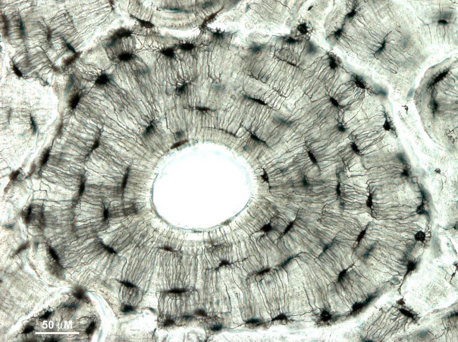<ul><li><p>basic functional unit of compact bone</p></li><li><p>made up of a central canal, lamellae, lacunae, and canaliculi</p></li></ul><p></p>