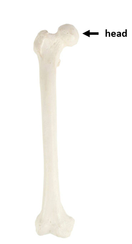 <p>What bone is this?</p>