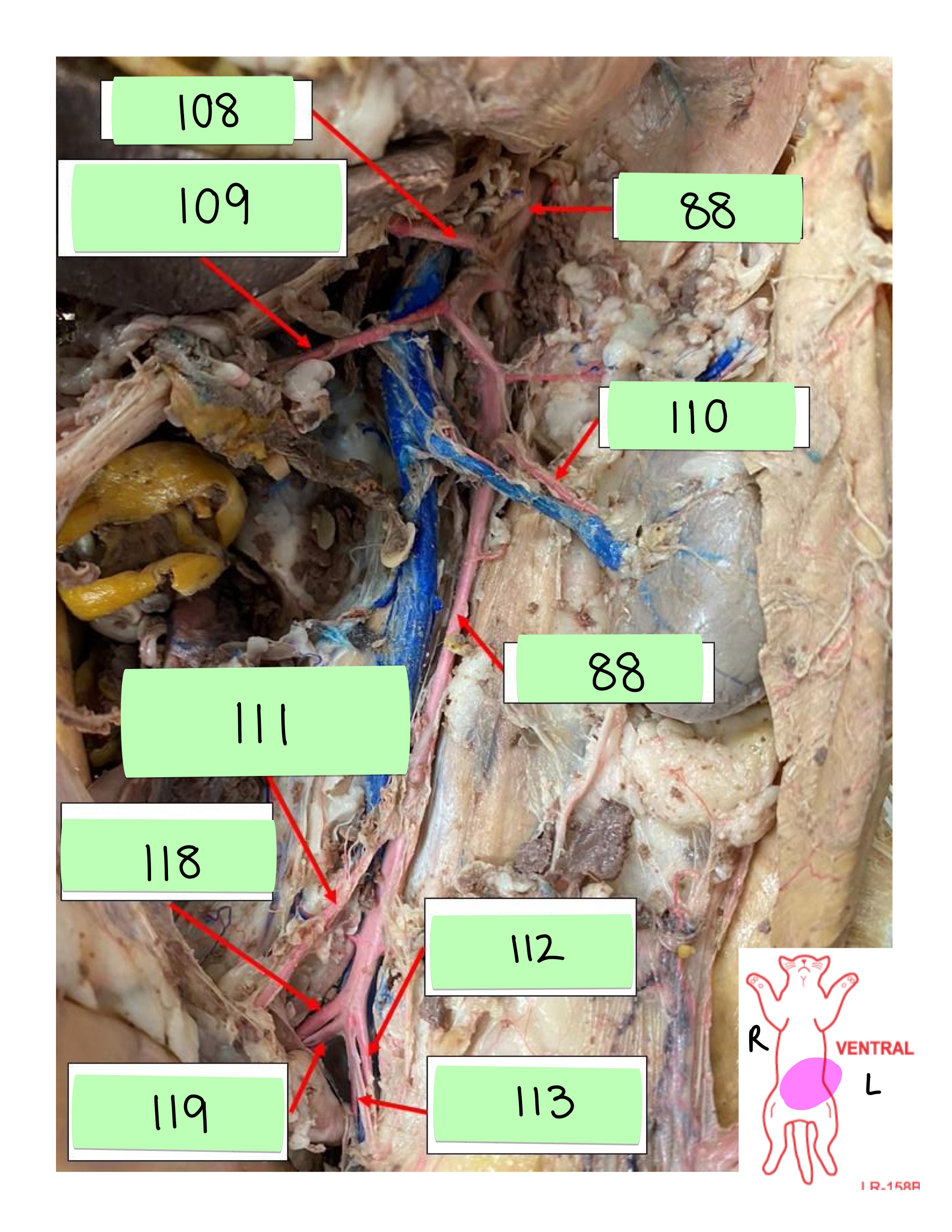 <p>left external iliac artery</p>