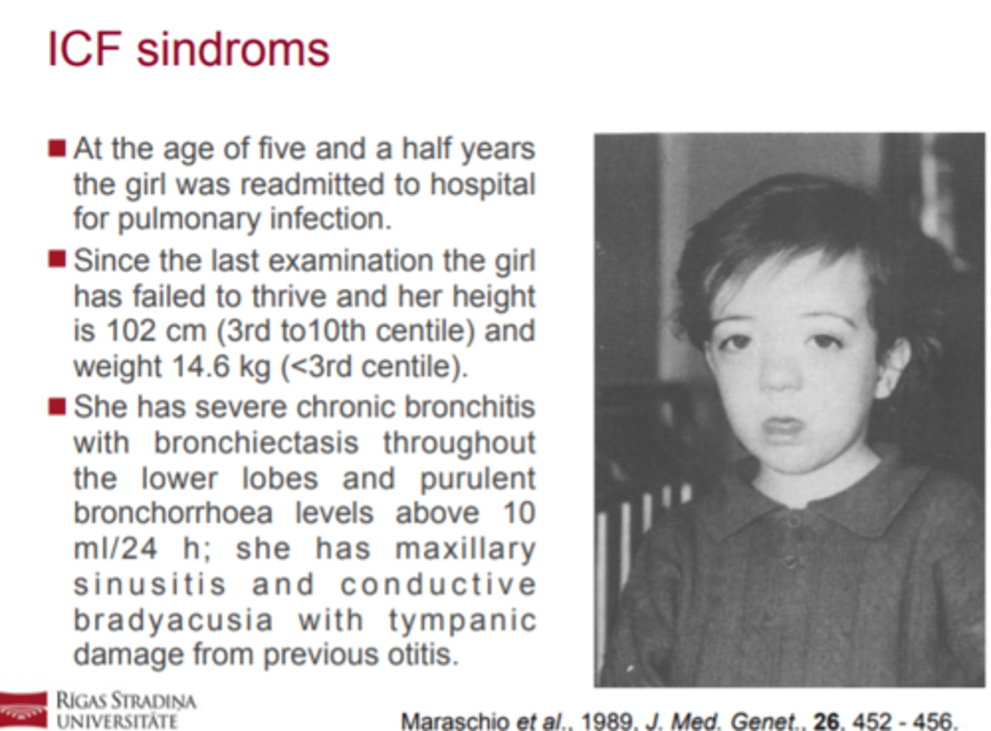 <p>! Imūndeficīts, centromēru nestabilitāte un sejas</p><p>dismorfisms (Immunodeficiency, Centromeric</p><p>instability, and Facial dysmorphy, ICF) ir reta</p><p>autosomāli recesīva patoloģija.</p><p>! Pacientiem ir atkārtotas respiratoras un/vai</p><p>gastrointestinālas infekcijas, sejas dismorfisms un</p><p>dažādas pakāpes garīgā atpalicība.</p>