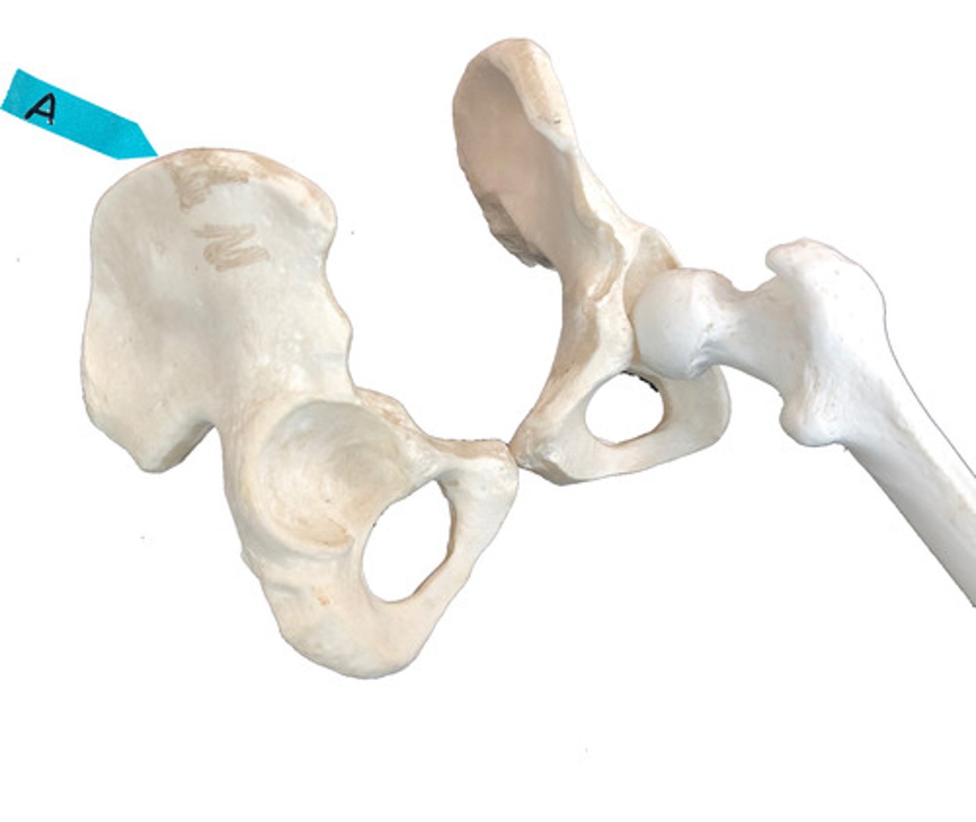 <p>Identify this bone marking.</p>