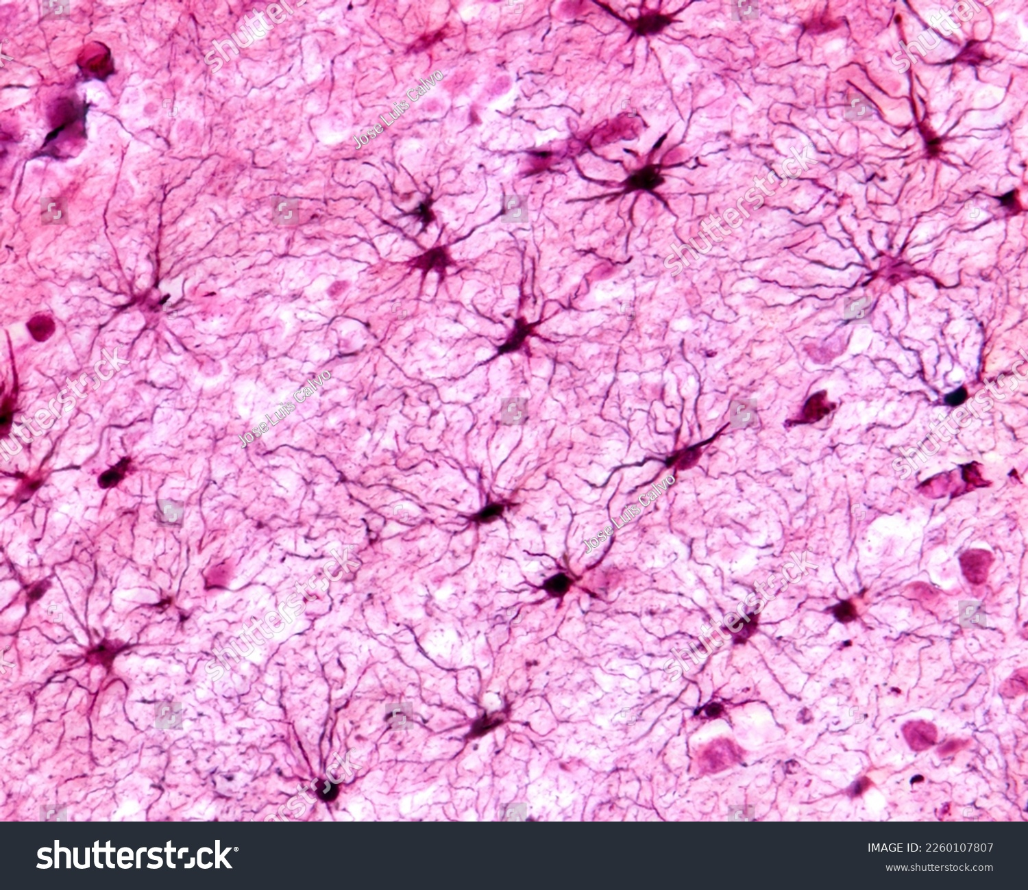 <p>a type of glial cell that fills space between neurons (influences neurite growth)</p><ul><li><p>majority of CNS neurons</p></li><li><p>regulates chemicals (like K+ ions) </p></li><li><p>stops neurotransmitters from spreading beyond synapses (can even remove them from the synaptic cleft) </p></li></ul>