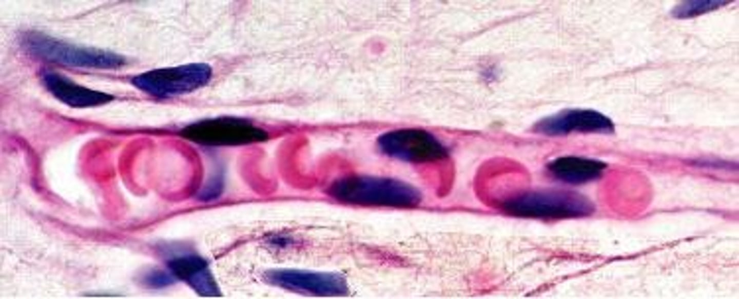 <p>A thin layer of cells lining blood vessels, providing a smooth surface for blood flow and facilitating exchange.</p>