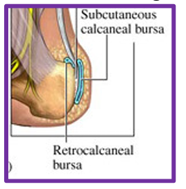 <ul><li><p>Bursa in the recess between the anterior inferior side of the Achilles tendon and the posterosuperior aspect of the calcaneus (retrocalcaneal recess) </p></li><li><p>Sometimes seen with insertional tendinopathy </p></li><li><p>Structural irritants (tight/pokey) </p></li><li><p>Pain just above the insertion of the Achilles Tendon  </p></li><li><p>Pain with squeeze from side </p></li></ul><p></p>