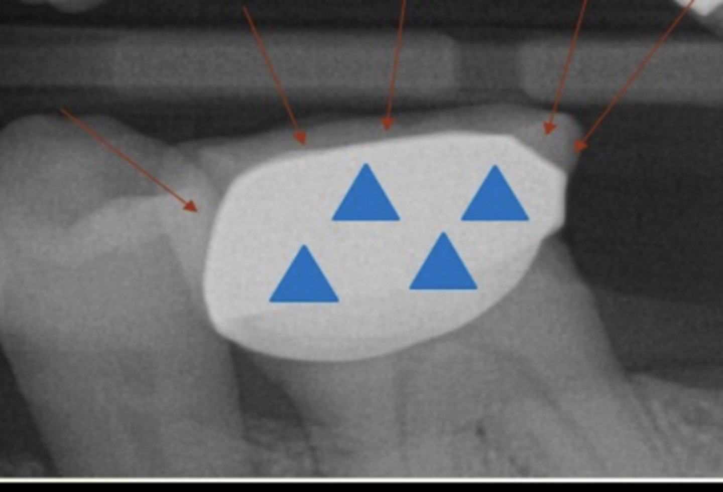 <p>What crown is this?</p>