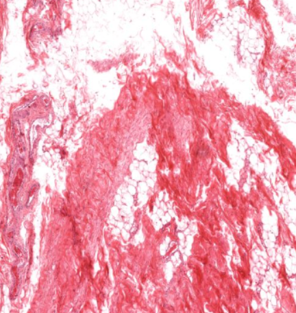 <p>type of connective tissue. Note the different types of fibers and cells</p>
