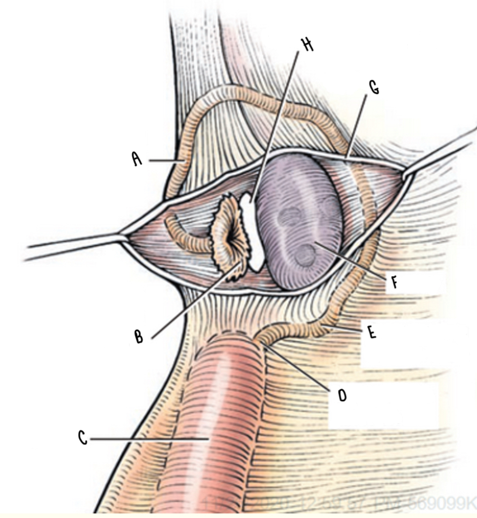 <p>What is the structure labeled C?</p>
