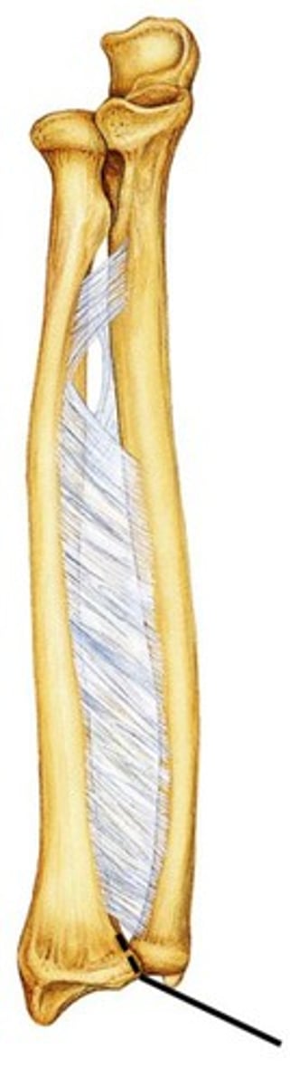 <p>articulates with the head of the ulna</p>