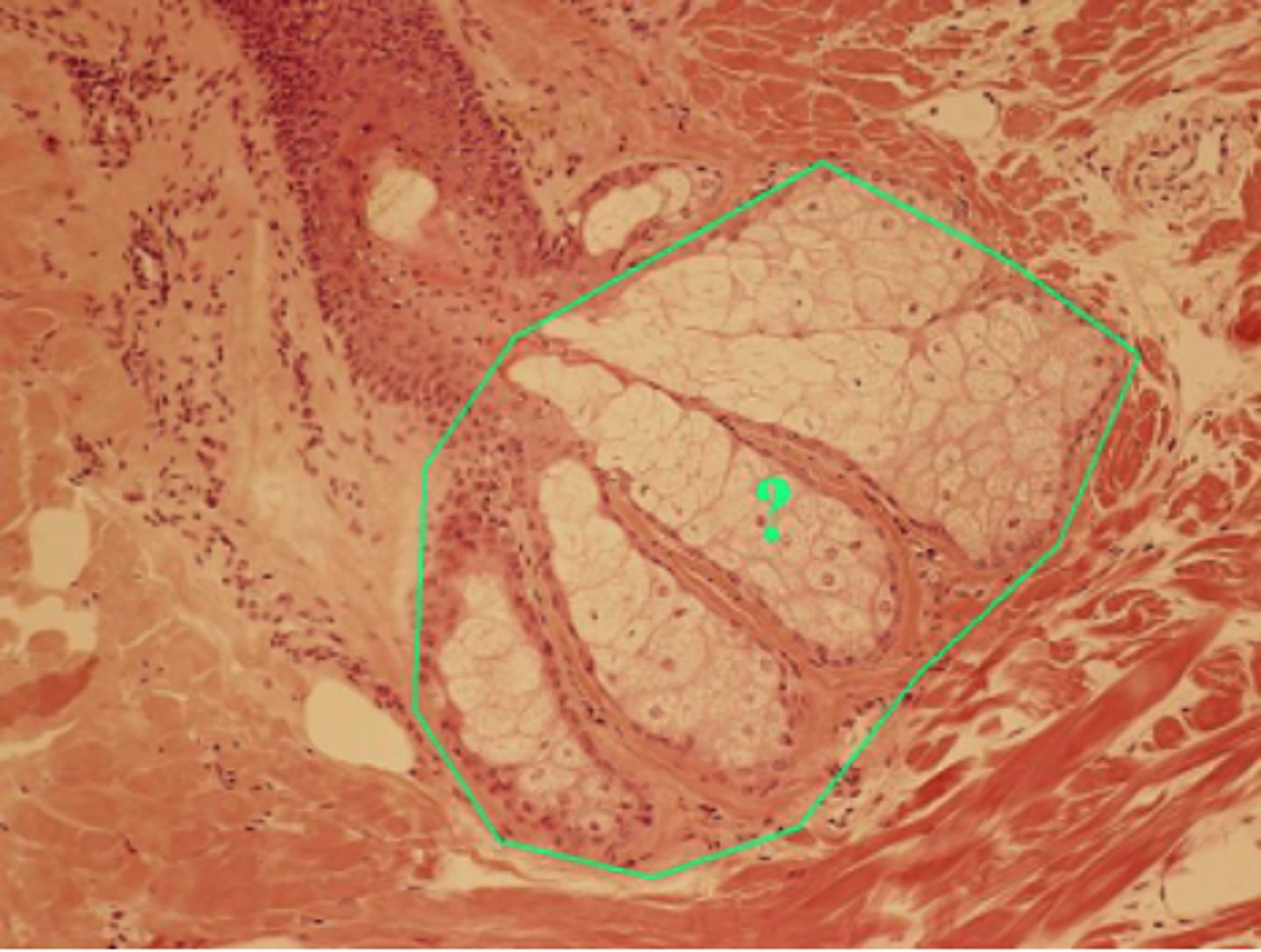 <p>sebaceous gland</p>