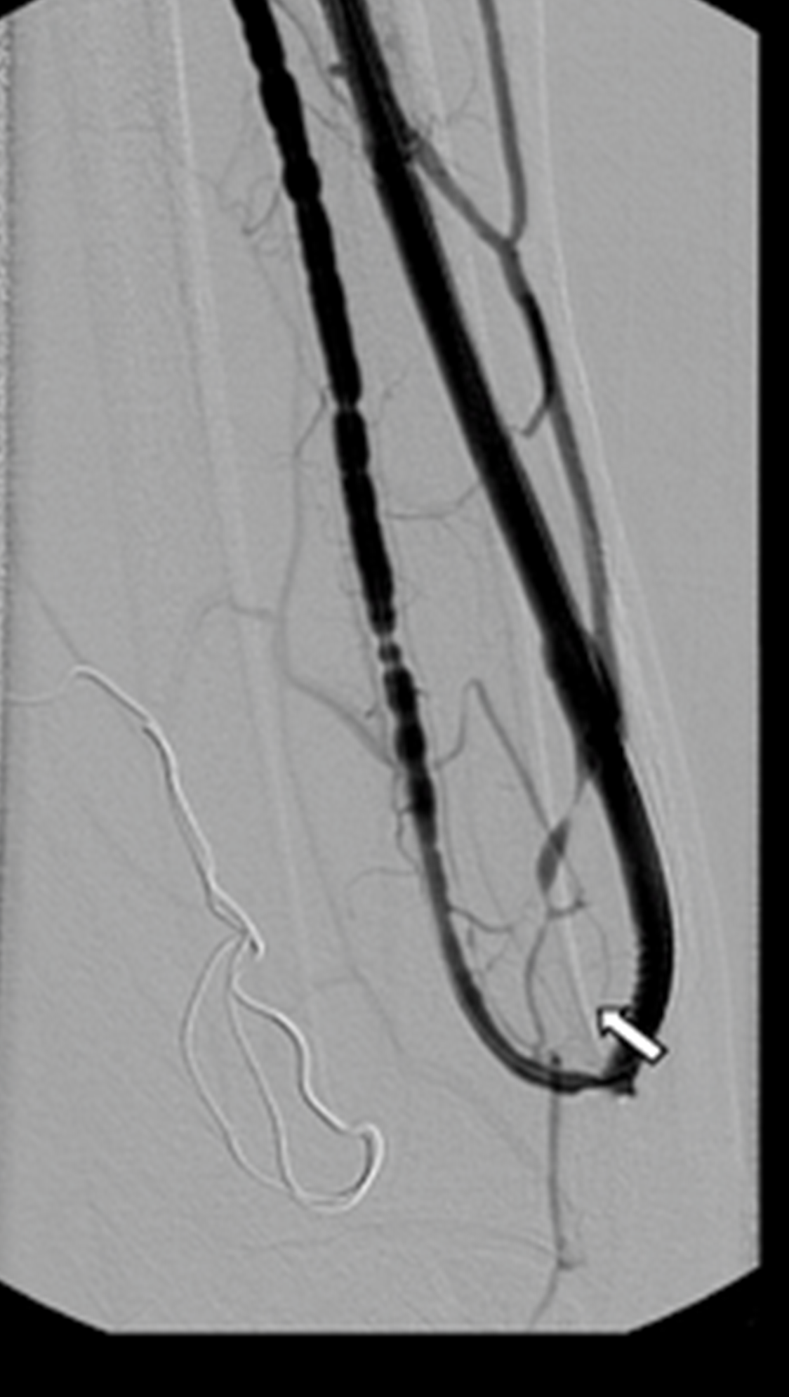 <p>identify the interventional procedure</p>