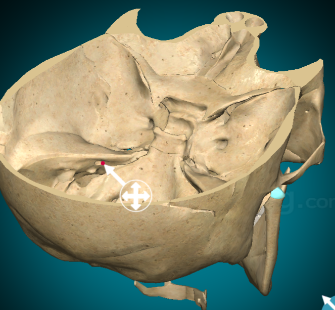 <p>Internal acoustic meatus</p>