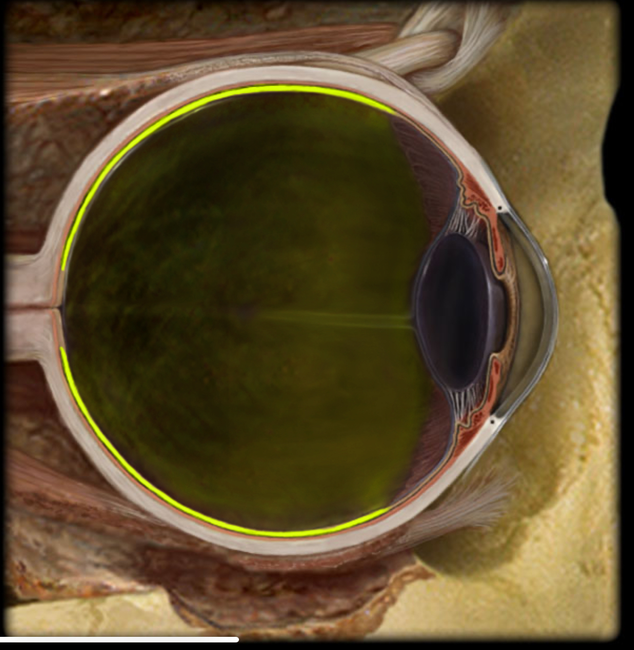 <h4 collapsed="false" seolevelmigrated="true"><strong>Location:</strong></h4><ul><li><p>Eye</p></li></ul><h4 collapsed="false" seolevelmigrated="true"><strong>Description:</strong></h4><ul><li><p>Inner tunic</p></li><li><p>Composed of two layers</p></li><li><p>Outer pigmented layer immediately inside choroid</p></li><li><p>Inner neural layer contains photoreceptors and associated neurons</p></li></ul><h4 collapsed="false" seolevelmigrated="true"><strong>Comment:</strong></h4><ul><li><p>Photoreceptors are primary sensory neurons that respond to light</p></li><li><p>Axons of retinal ganglion cells form optic nerve (CN I), which connects eye to brain</p></li></ul>