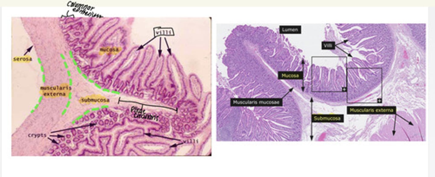<p>i. Plicae circulares</p><p>ii. Columnar epithelium</p><p>iii. Villi</p><p>iv. Intestinal glands</p><p>v. Mucosa 1. Absorptive cells 2. Goblet cells 3. Brush boarder vi. Submucosa</p><p>vii. Muscularis externa</p><p>viii. Serosa</p>