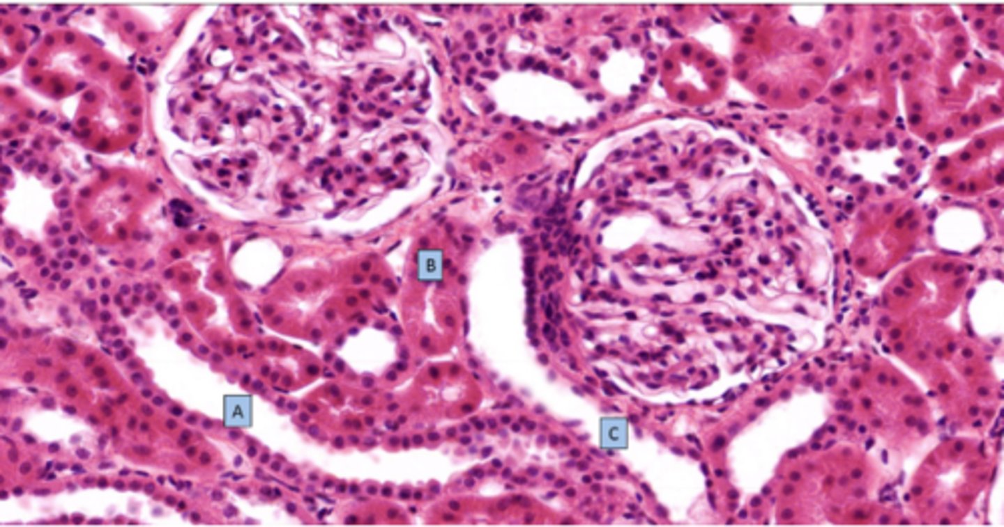 <p>What is the structure at C</p>