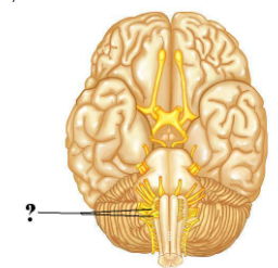 <p><span>Identify the indicated cranial nerve.</span></p>