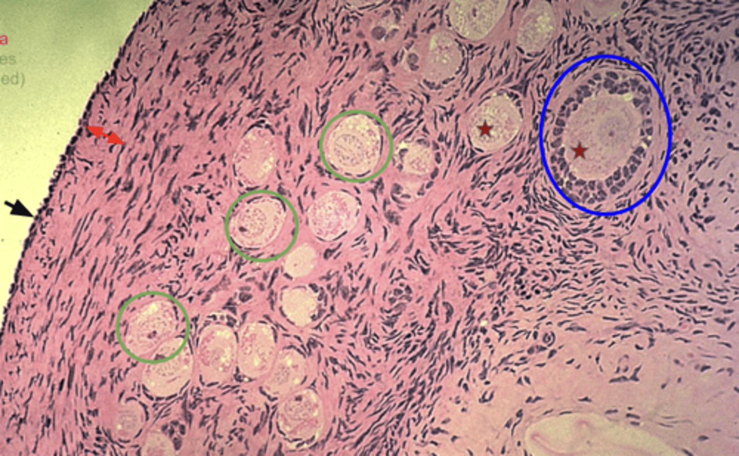 <p>What is the red star?</p>