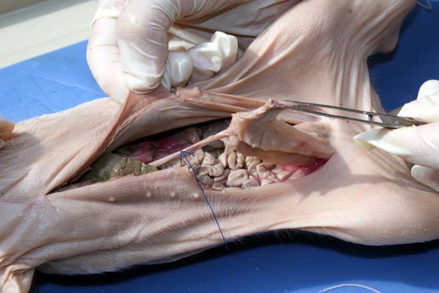 <p>Umbilical vein</p>