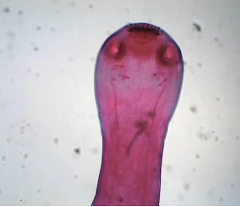 <p>Taenia saginata </p>