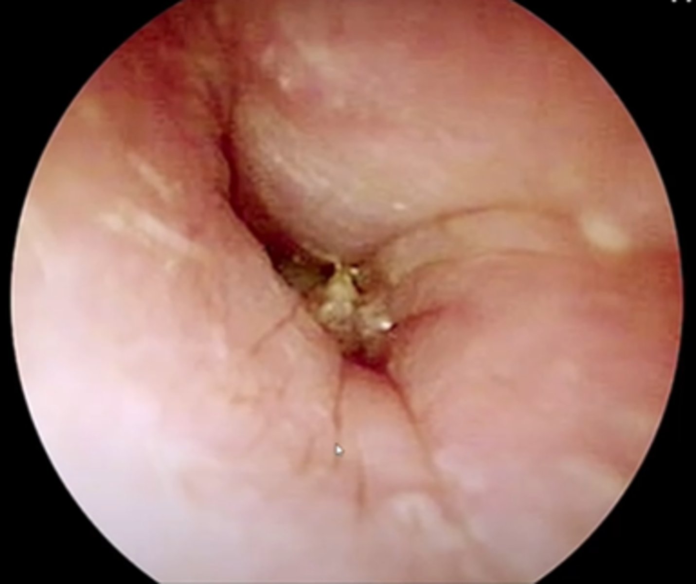 <p>What is this?<br><br>-Btw this is an ear</p>