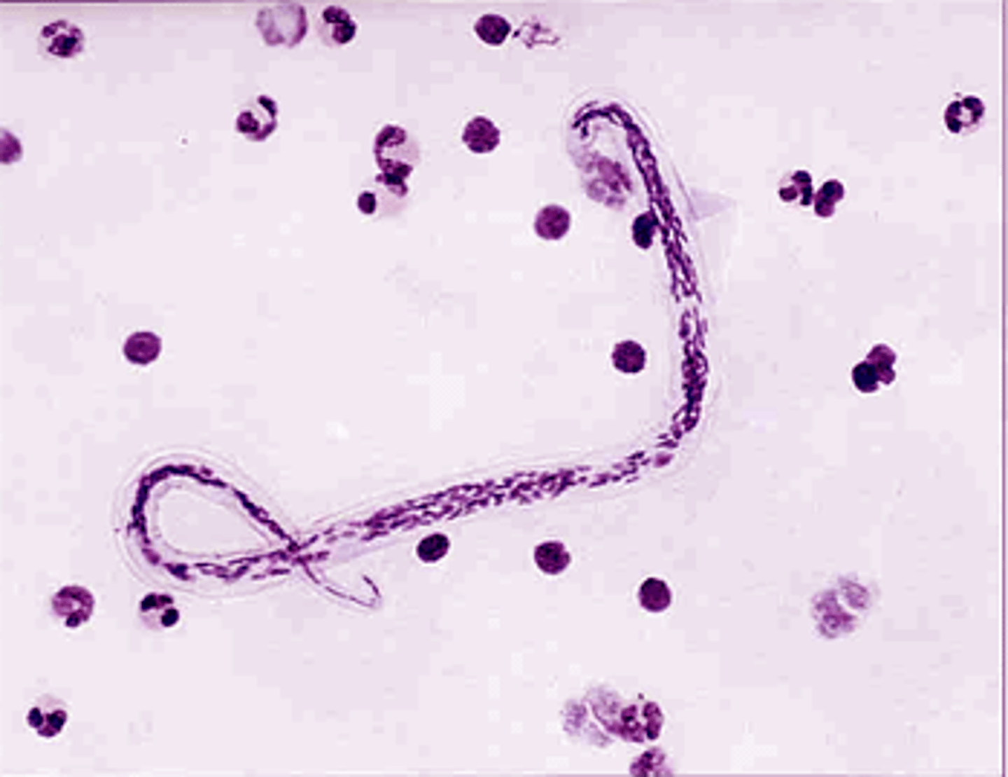 <p>*notice the converging nuclei into one row<br><br>*sheath is present</p>