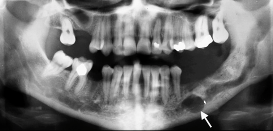 <p>likely diagnosis?</p>