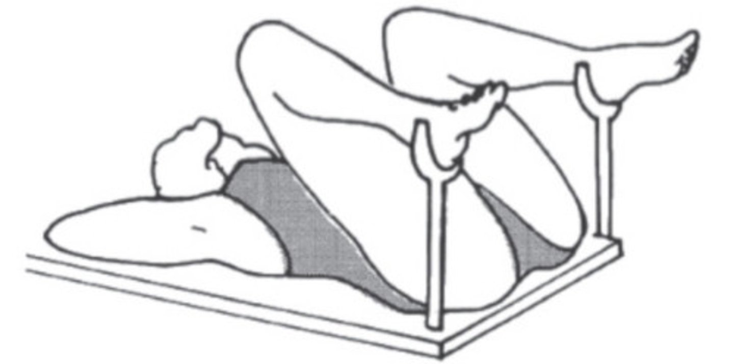 <p>The patient is assisted into supine (lying on the back) position. The legs are sharply flexed at the knees, and the feet are placed in stirrups. This position is used for vaginal examination and the Papanicolaou (Pap) test.</p>