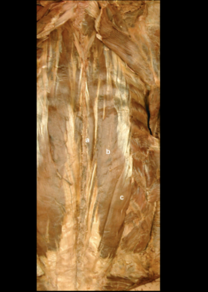 <p>Erector Spinae Muscles</p>