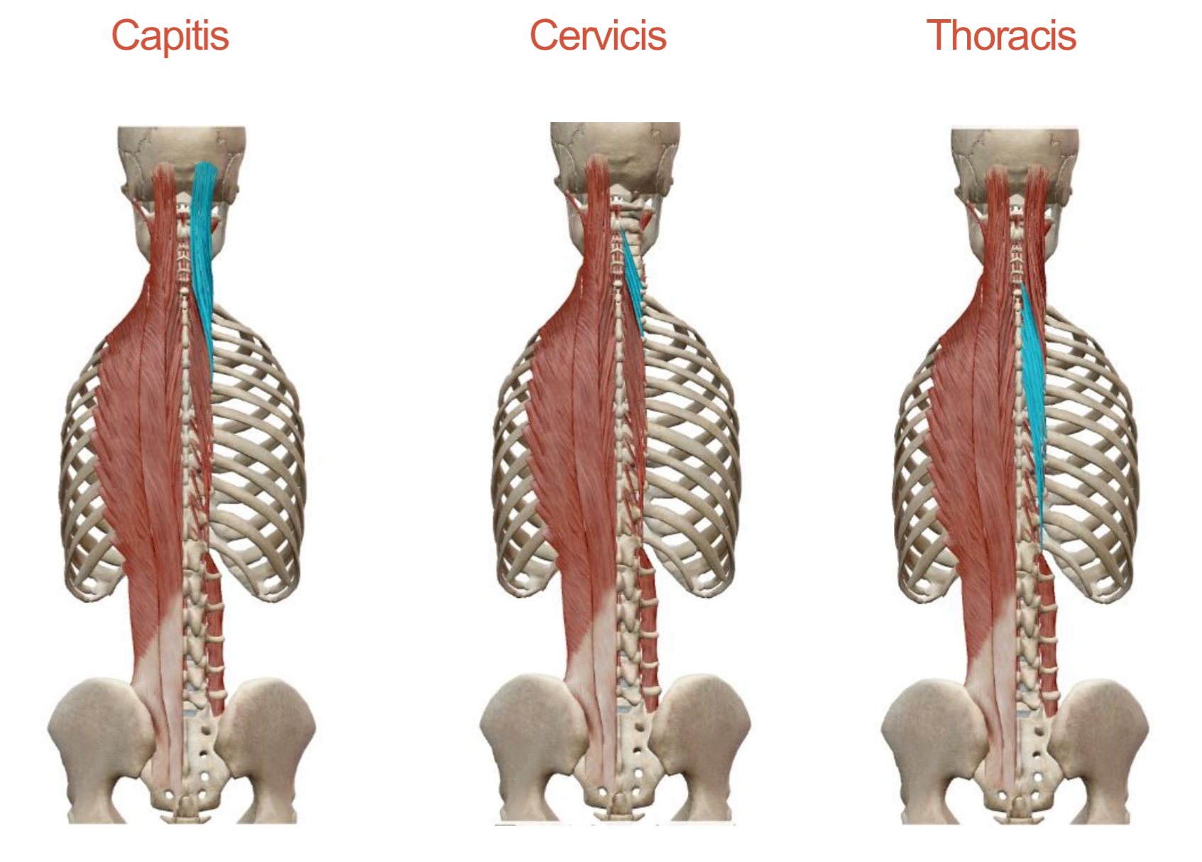 <p>Transversospinalis/Semispinalis</p><p>Origin: </p><p><strong>Capitis</strong>: TP of C7 and T1-T7 and AP of C4-C6</p><p><strong>Cervicis</strong>: TP of T1-T6</p><p><strong>Thoracis</strong>: TP of T6-T10</p><p>Insertion: </p><p><strong>Capitis</strong>: Occipital Bone</p><p><strong>Cervicis</strong>: Spinous processes of C1-5</p><p><strong>Thoracis</strong>: Spinous processes of C6-C7 and T1-T4</p><p>Action: <strong>Together</strong>: Extend vertebral column at respective region <strong>Singly</strong>: Rotate head to the opposite side</p><p>Innervation: Spinal Nerves</p>