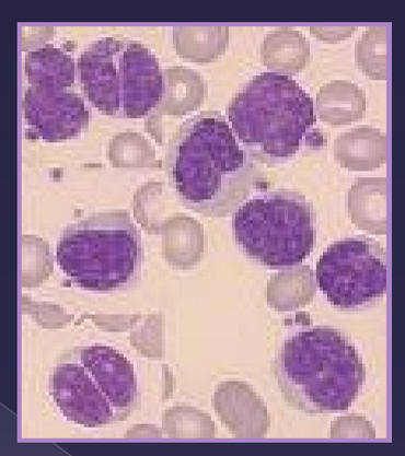 <ul><li><p>screening tool </p><ul><li><p>performed as a first step </p></li></ul></li><li><p>cellular sample only </p></li><li><p>specific but not sensitive </p></li><li><p>etiologies </p><ul><li><p>bacterial </p></li><li><p>fungal </p></li><li><p>neoplasia - mesenchymal, epithelial </p></li></ul></li></ul><p></p>