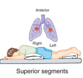 <p>What CPT position is pictured, and when is it used?</p>