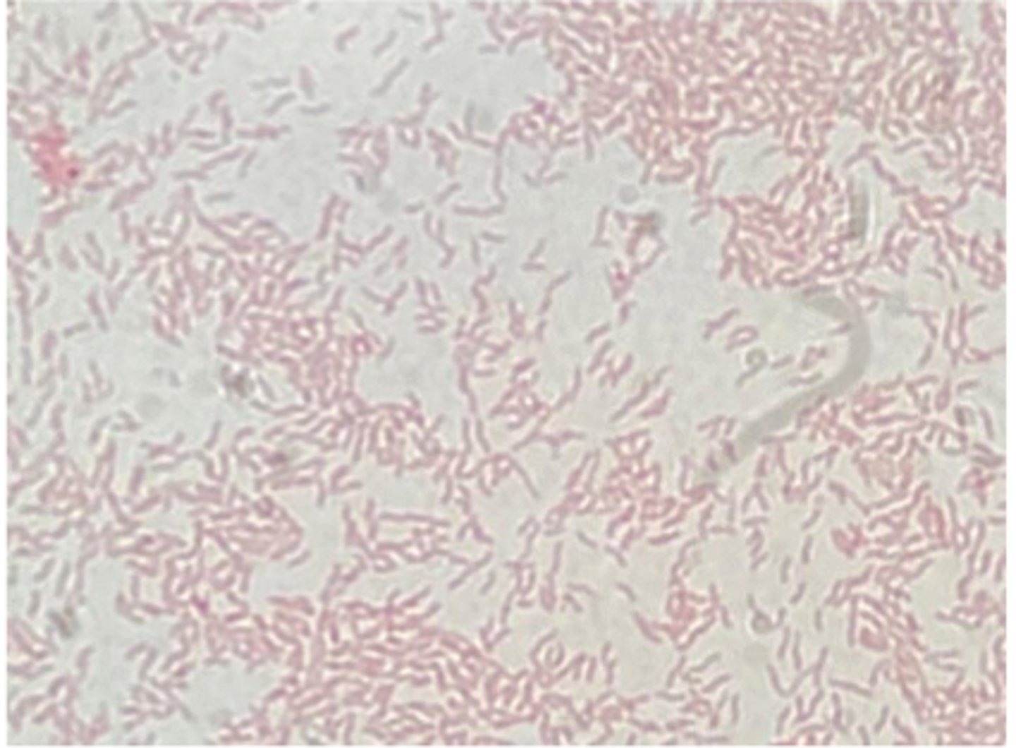 <p>Examine a gram-stained smear made from stomach contents of a sheep fetus which was aborted shortly before term. About 10% of the flock aborted. The fetal liver displayed multifocal, round "doughnut-like" necrotic</p><p>lesions.</p>