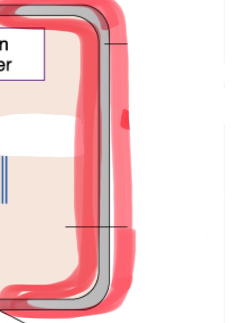 <p>metal housing of tubehead</p>