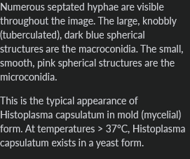 <p>histoplasma capsulatum (mld form)</p><p></p>