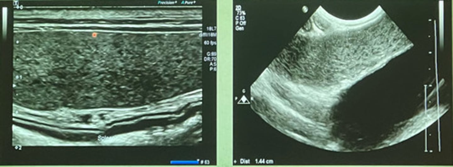 <p>are these ultrasound images of the spleen focal or diffuse?</p>