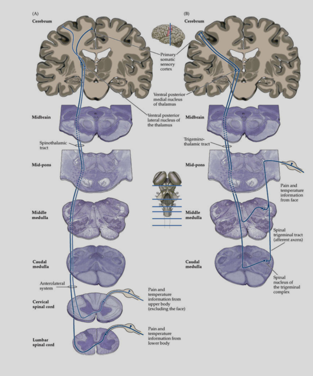 <p><span>1.	Dorsal Column–Medial Lemniscal (DCML) pathway – conveys fine touch, vibration, proprioception.</span></p><p class="p1"><span>	</span></p><p class="p1"><span>2.	Spinothalamic Tract (STT; anterolateral system) – conveys pain, temperature, crude touch.</span></p><p class="p1"><span>Second-order neurons from both systems decussate and project to the thalamus:</span></p><p class="p2"></p><p class="p1"><span>•	VPL: sensory input from the body</span></p><p class="p1"><span>•	VPM: sensory input from the face</span></p><p class="p4"></p><p class="p1"><span>Decussation means crossing the midline. DCML crosses in the medulla, whereas STT crosses immediately in the spinal cord, explaining different patterns of sensory loss after lesions.</span></p>