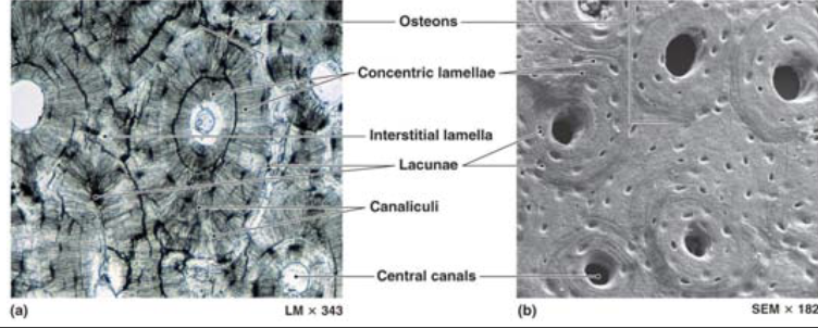 <p>the functional unit of compact bone is the </p>