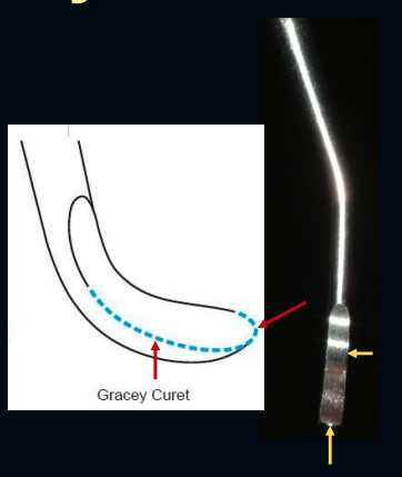 <p>1 lateral edge + toe</p>