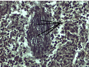 <p>Fibers arranged in circle shape. Function is for lymph nodes structure, and support and strengthen the tissues. Found in lymph nodes, spleen and bone marrow</p>